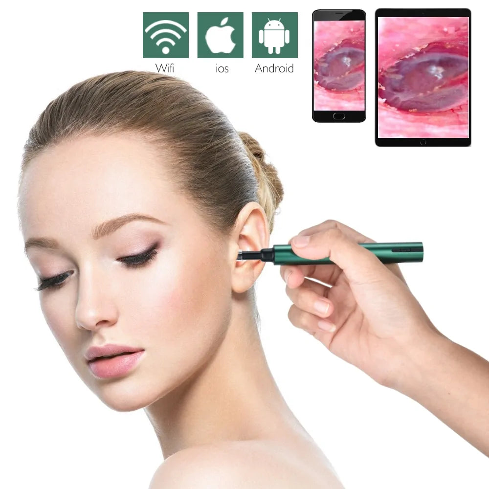 Wireless Ear Scope Camera Earwax Removal Tool